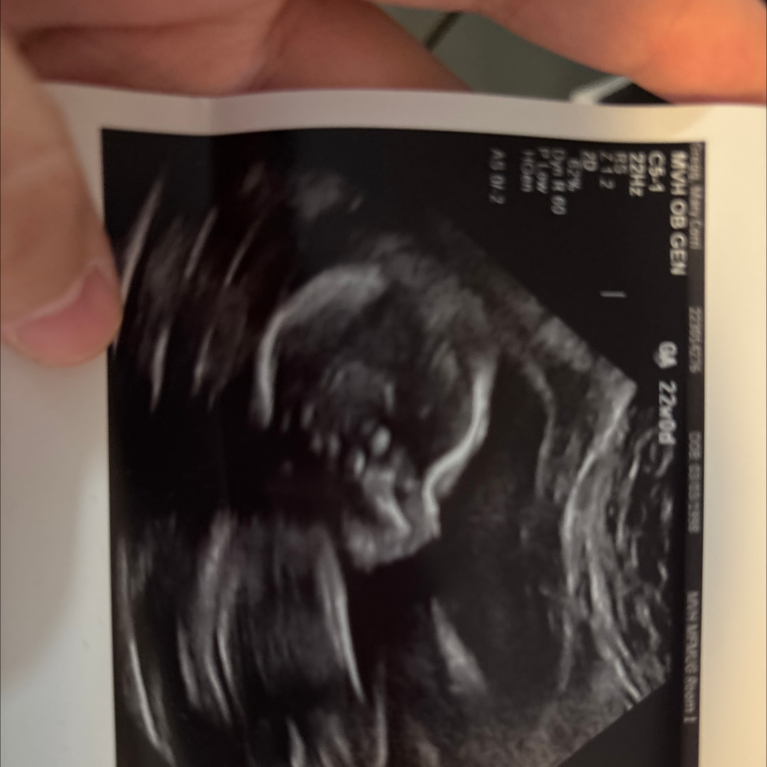Photo shared by Mary for their Babylist baby registry.
