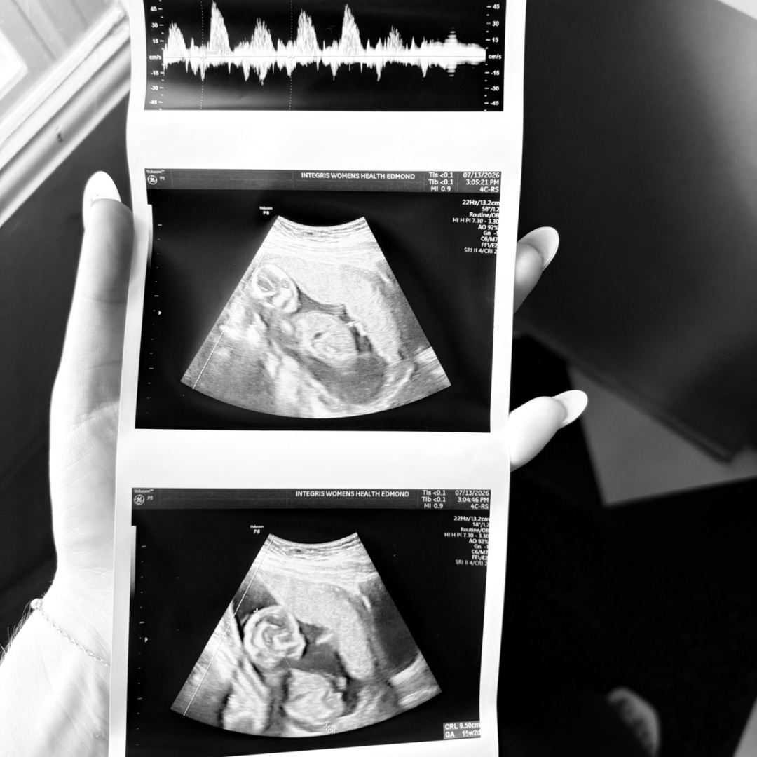 Photo shared by Lawson for their Babylist baby registry.