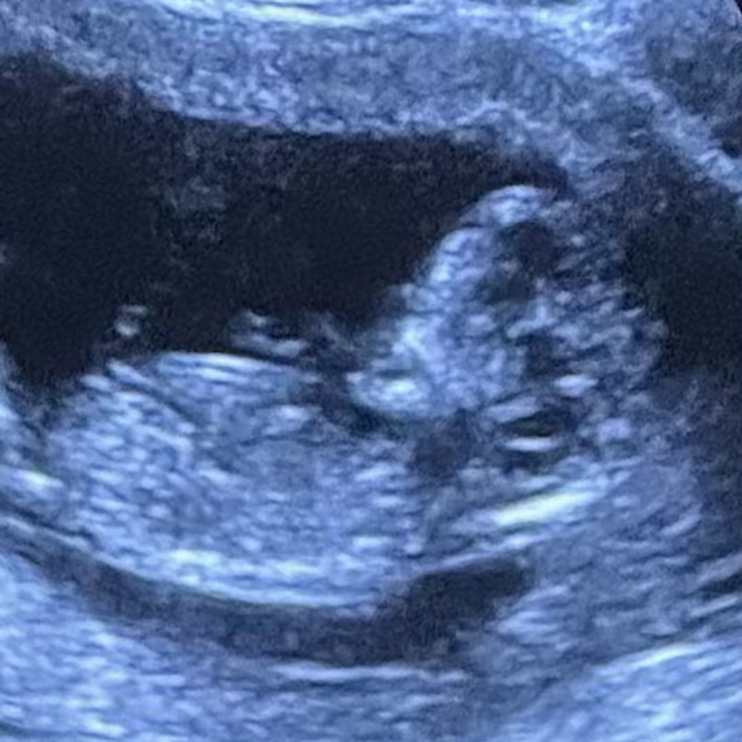 Photo shared by Elijah for their Babylist baby registry.