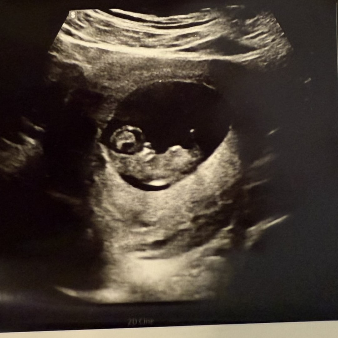 Photo shared by Leah for their Babylist baby registry.