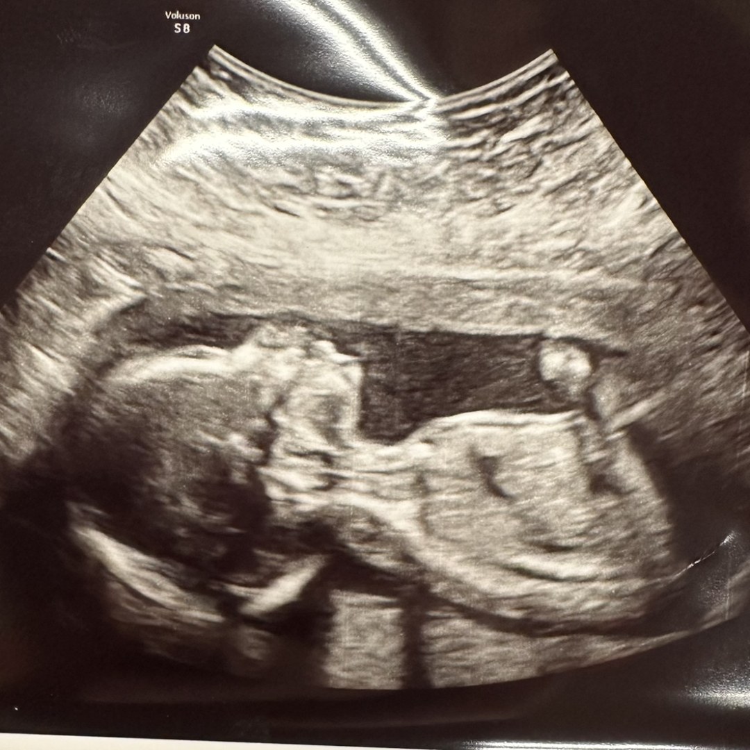 Photo shared by Hannah for their Babylist baby registry.