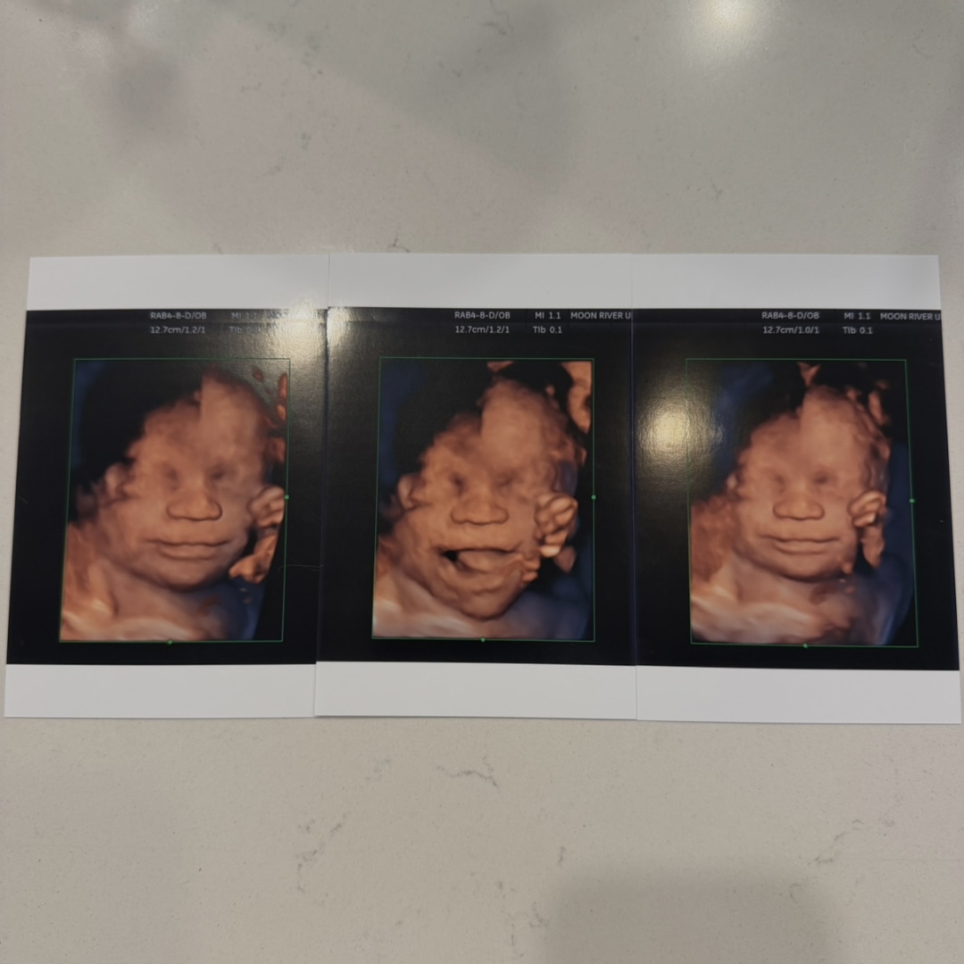 Photo shared by Ava for their Babylist baby registry.