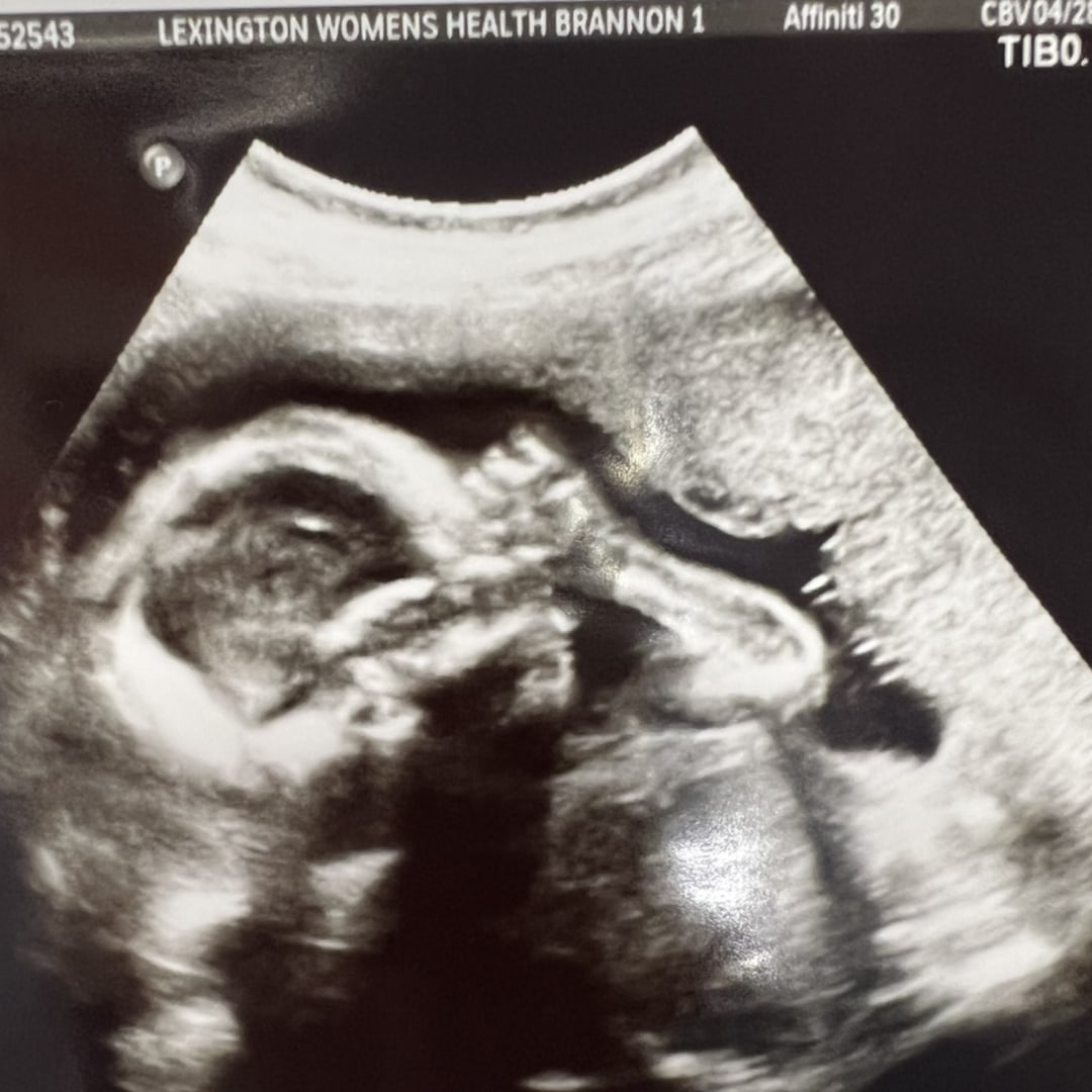Photo shared by Courtney for their Babylist baby registry.