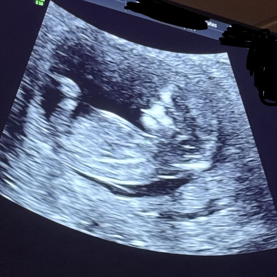 Photo shared by Sydney for their Babylist baby registry.