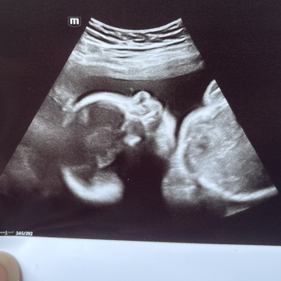 Photo shared by Savannah for their Babylist baby registry.