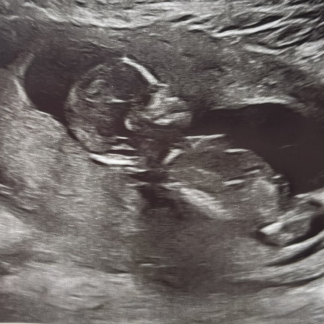 Photo shared by Laura for their Babylist baby registry.