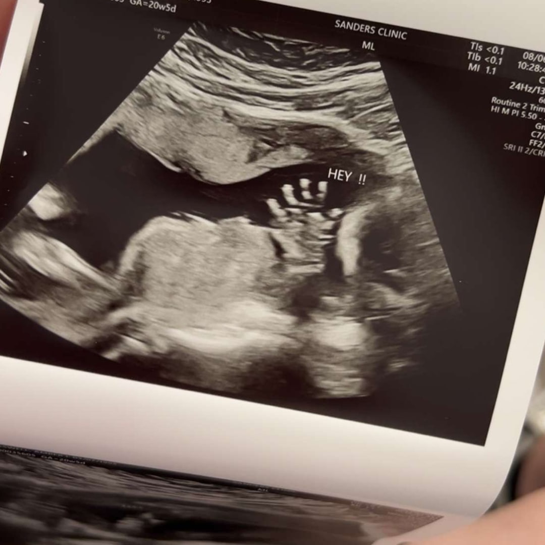 Photo shared by Amber for their Babylist baby registry.