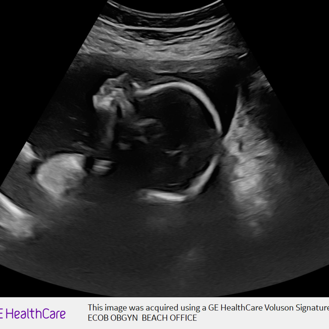 Photo shared by Chelsea for their Babylist baby registry.