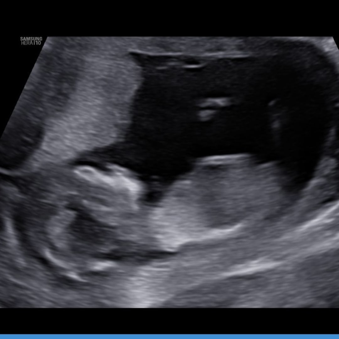 Photo shared by Priscilla for their Babylist baby registry.