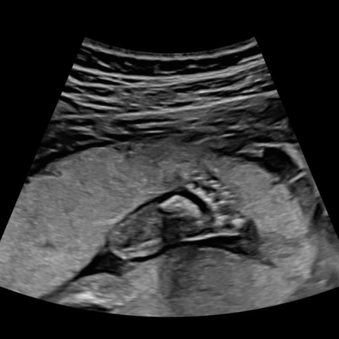 Photo shared by Amanda for their Babylist baby registry.