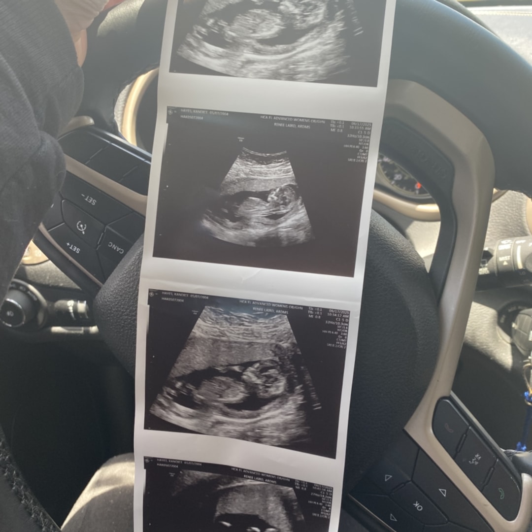 Photo shared by Kandice for their Babylist baby registry.