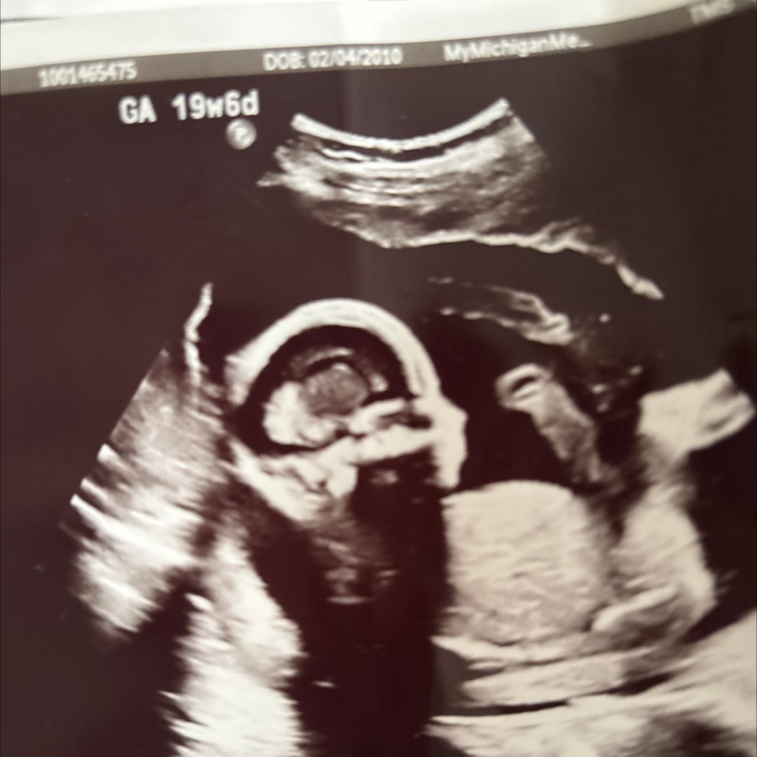 Photo shared by Cady for their Babylist baby registry.