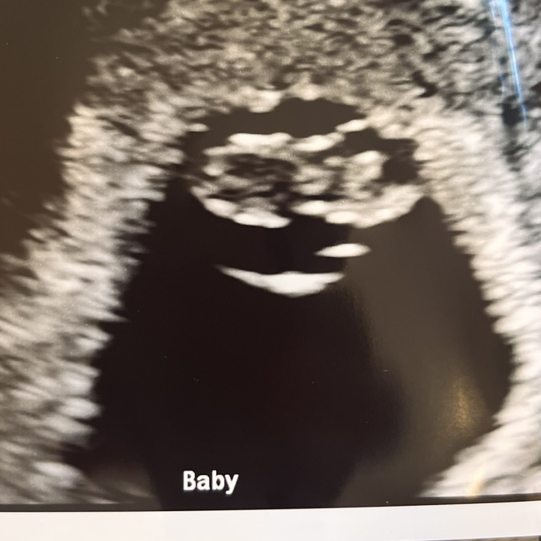 Photo shared by Payton for their Babylist baby registry.