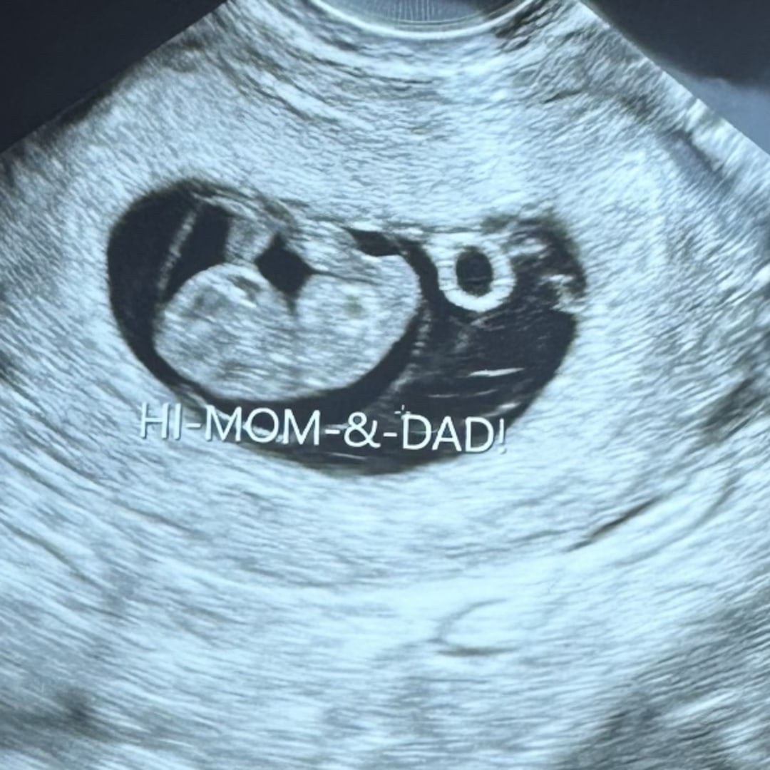 Photo shared by Ashley for their Babylist baby registry.