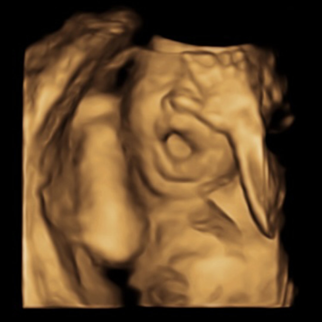 Photo shared by Hunter for their Babylist baby registry.