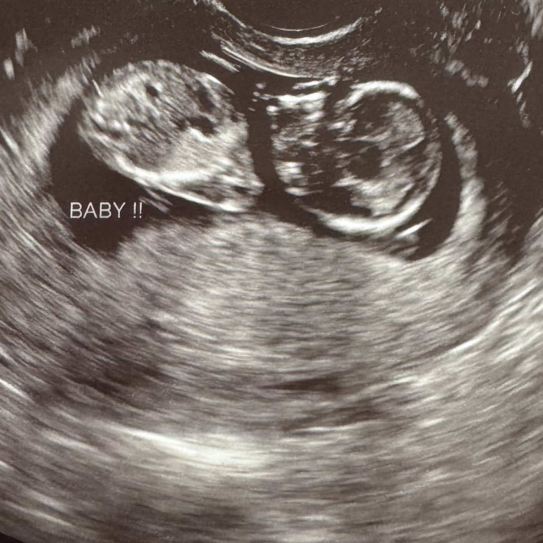 Photo shared by Brandi for their Babylist baby registry.