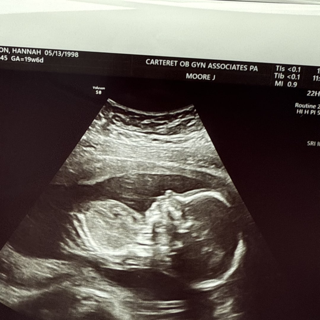 Photo shared by Hannah for their Babylist baby registry.