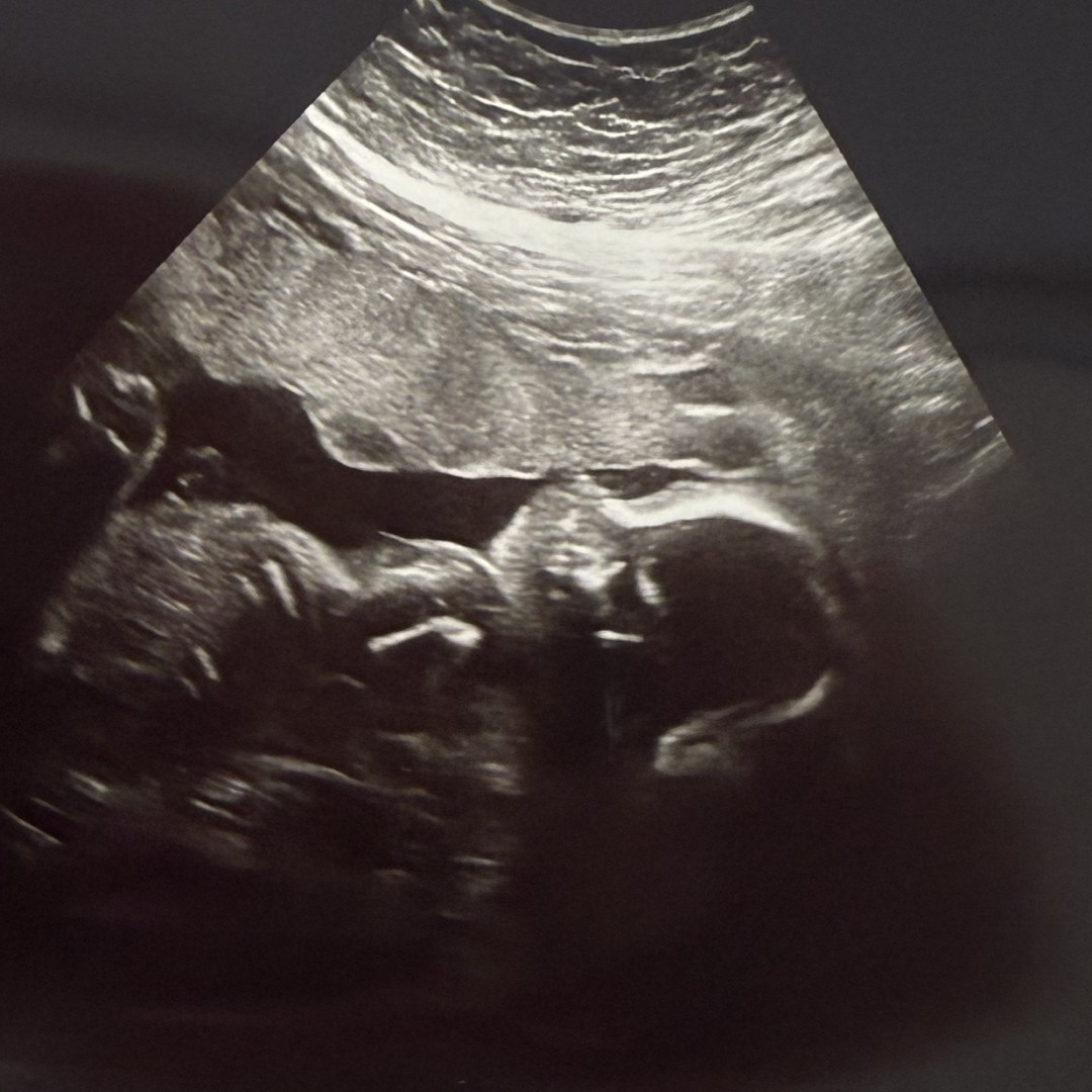 Photo shared by Kelsey for their Babylist baby registry.