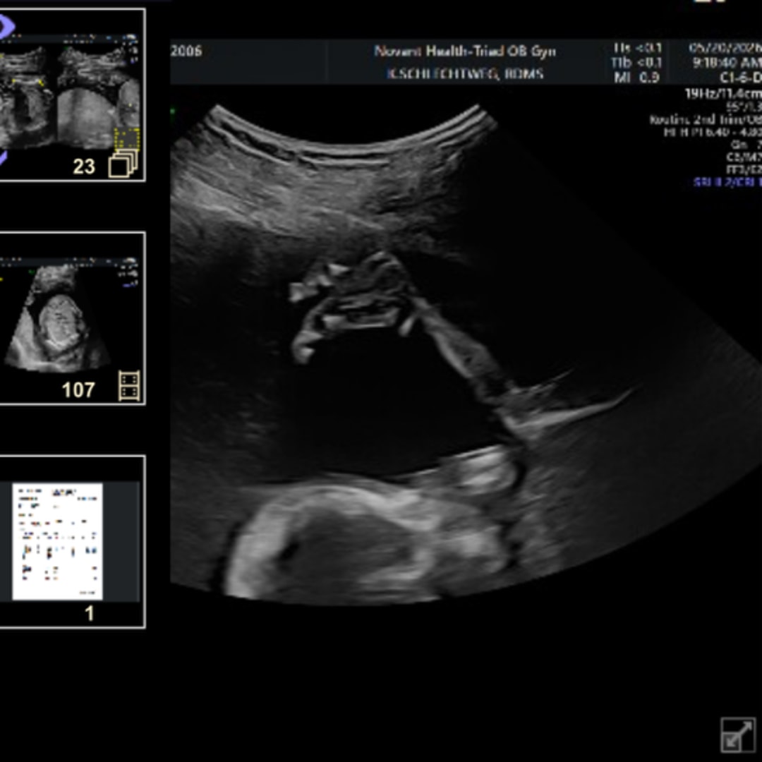 Photo shared by Leah for their Babylist baby registry.