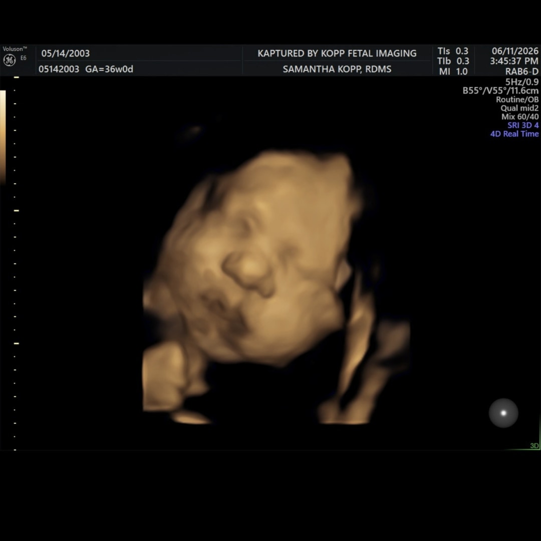 Photo shared by Ashalyn for their Babylist baby registry.
