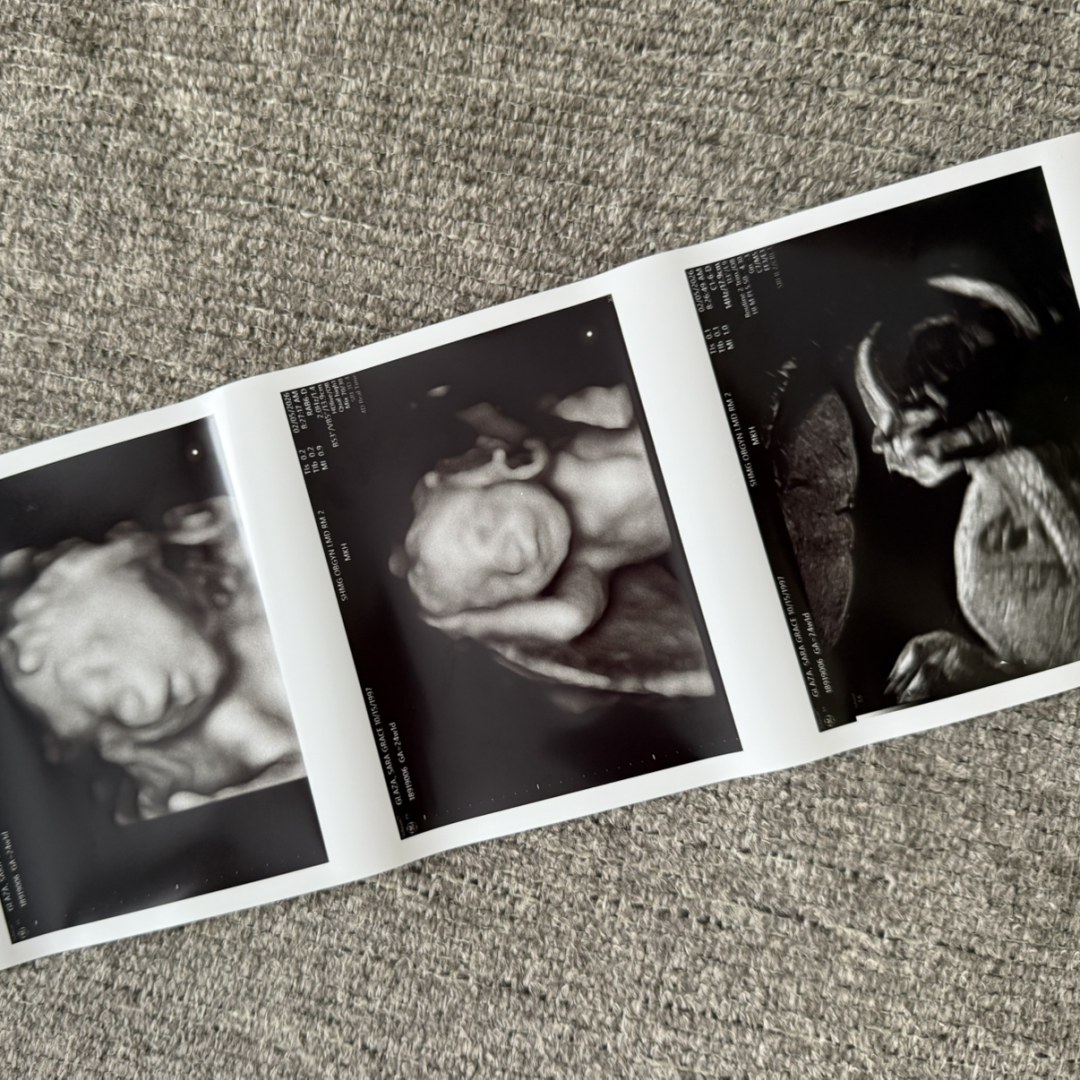 Photo shared by Sara for their Babylist baby registry.