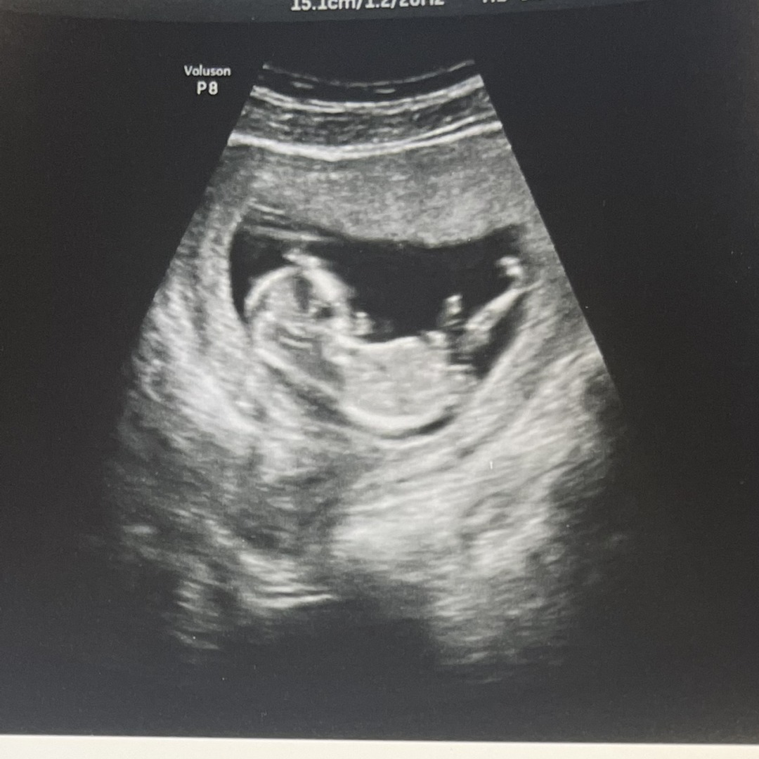 Photo shared by Jenna & Alex for their Babylist baby registry.