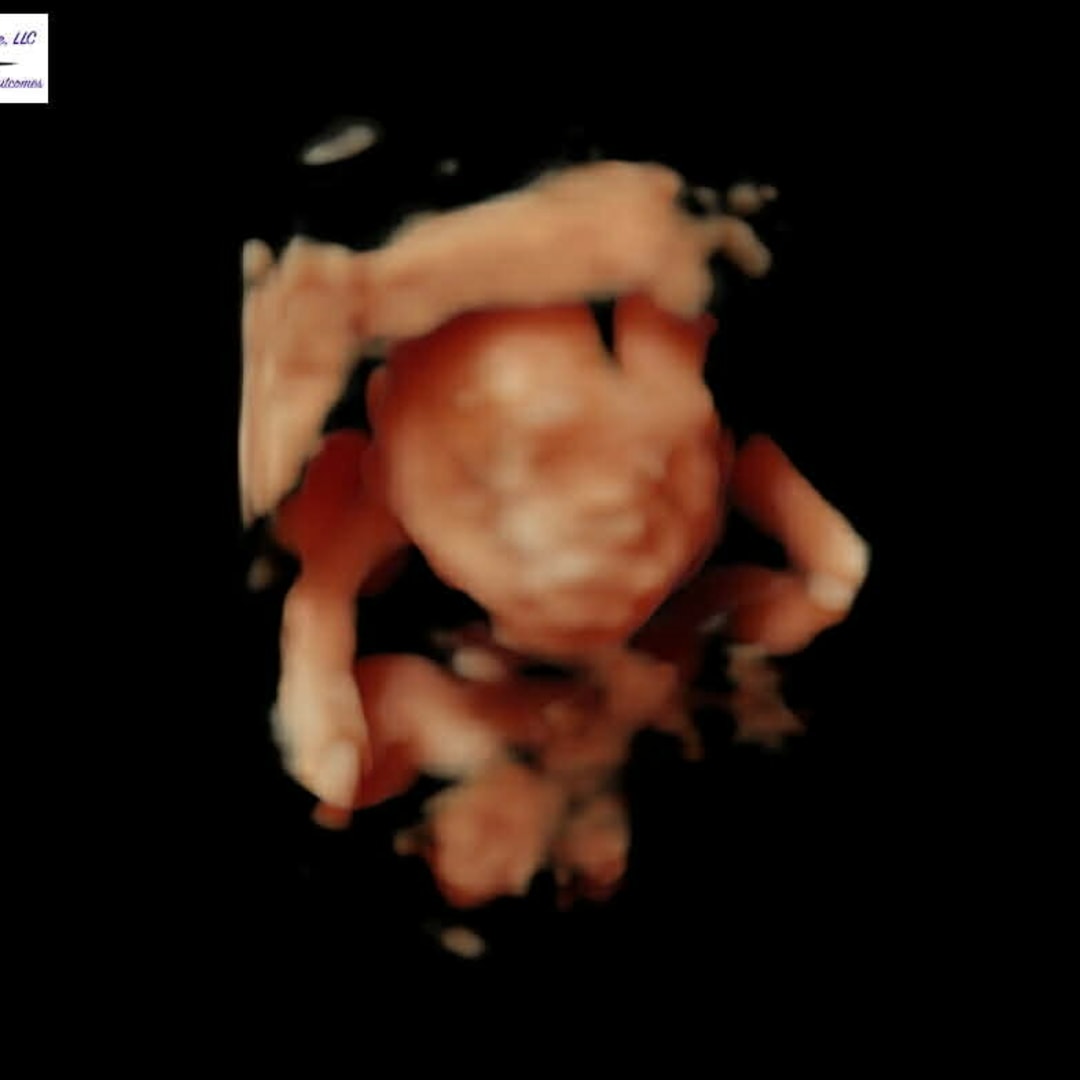 Photo shared by Julianna for their Babylist baby registry.