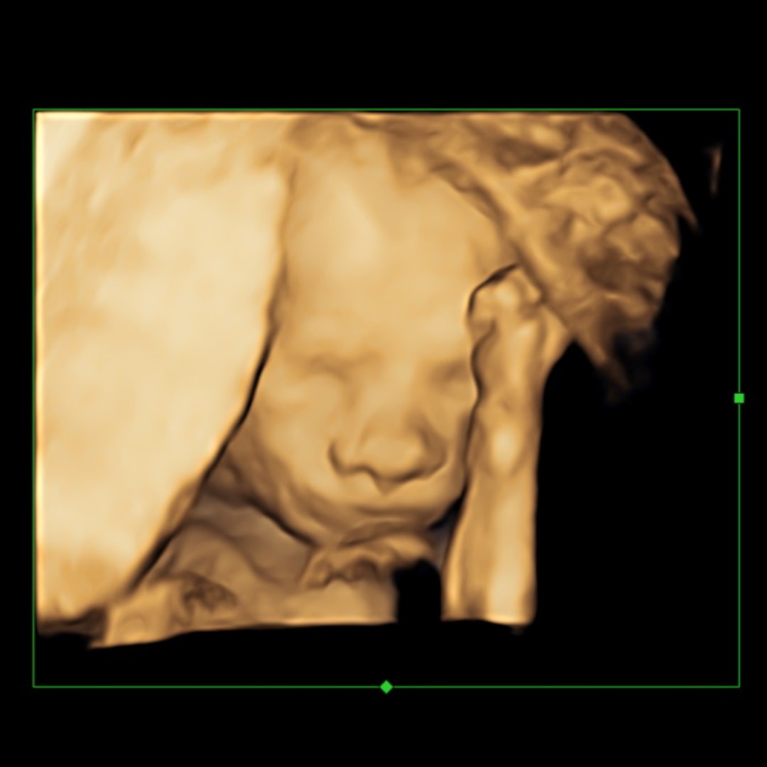 Photo shared by Kayla for their Babylist baby registry.