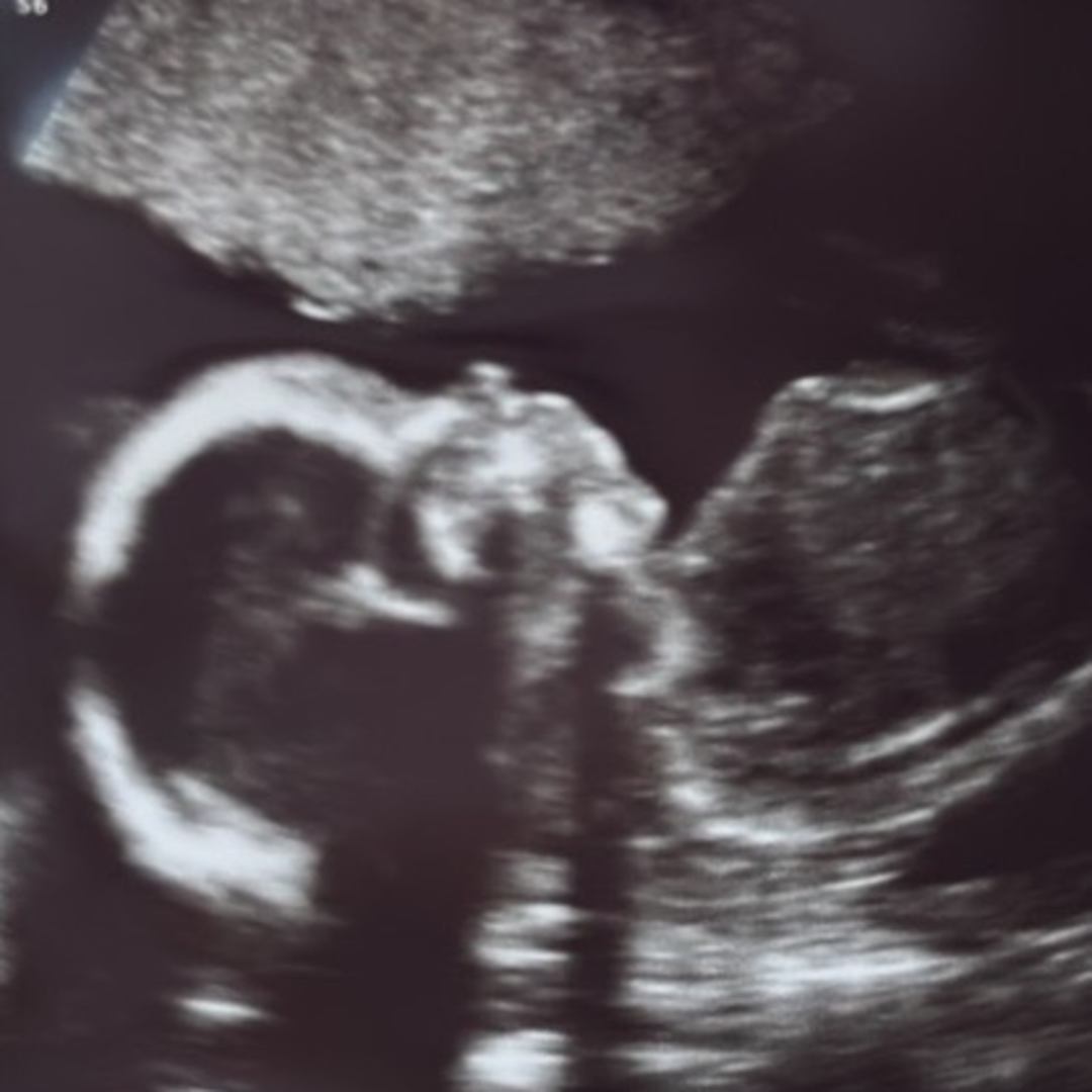 Photo shared by Alex for their Babylist baby registry.