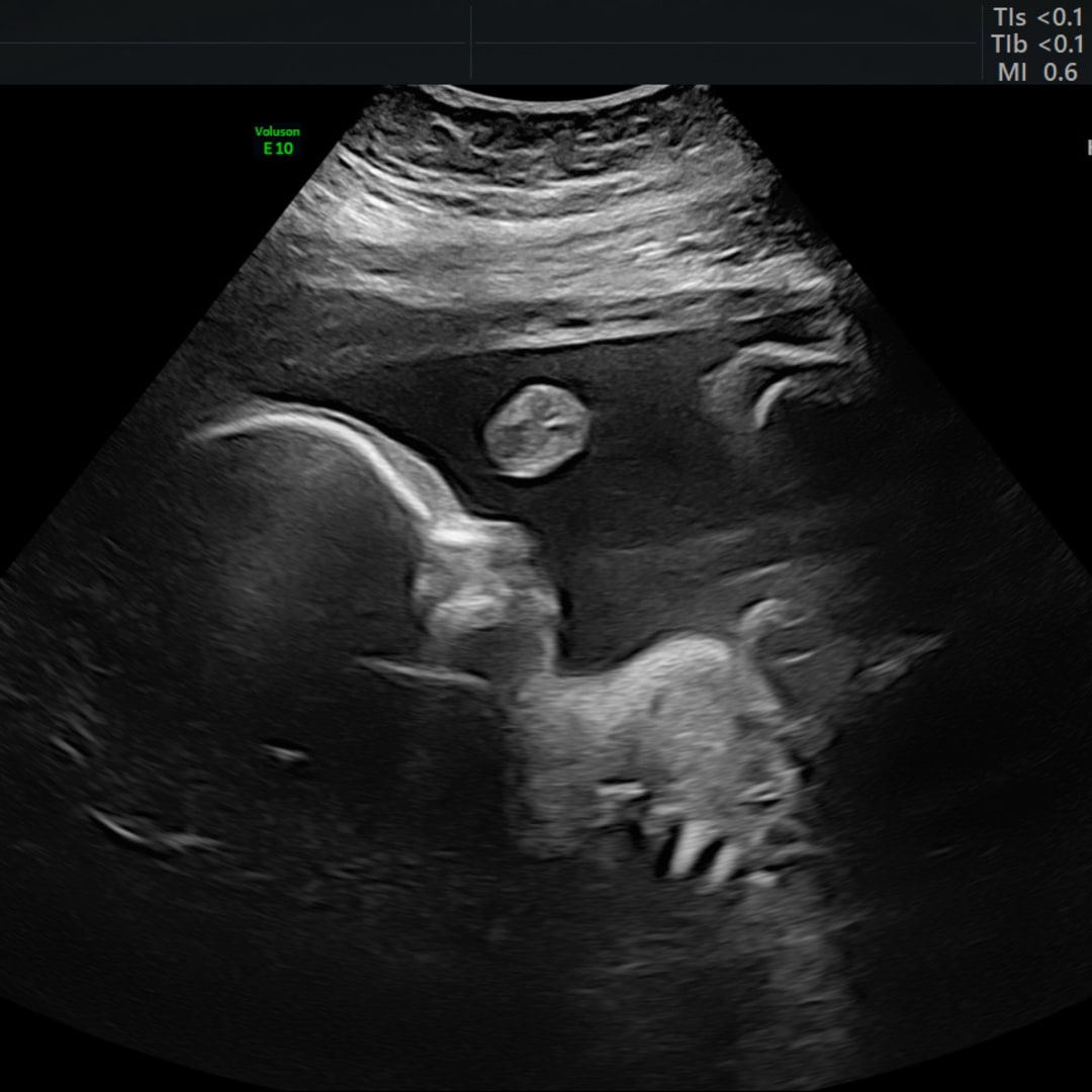 Photo shared by Guenavere for their Babylist baby registry.