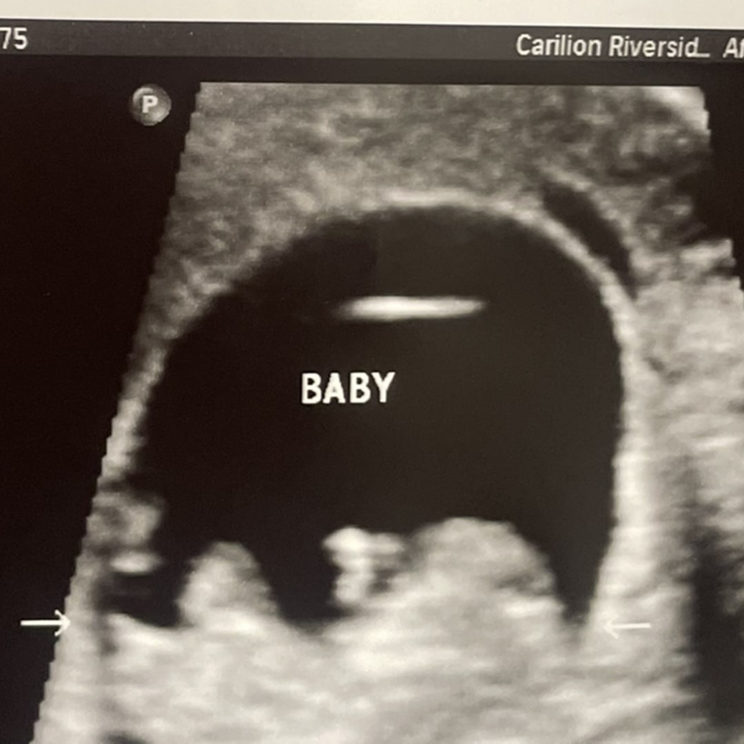 Photo shared by Mariana for their Babylist baby registry.