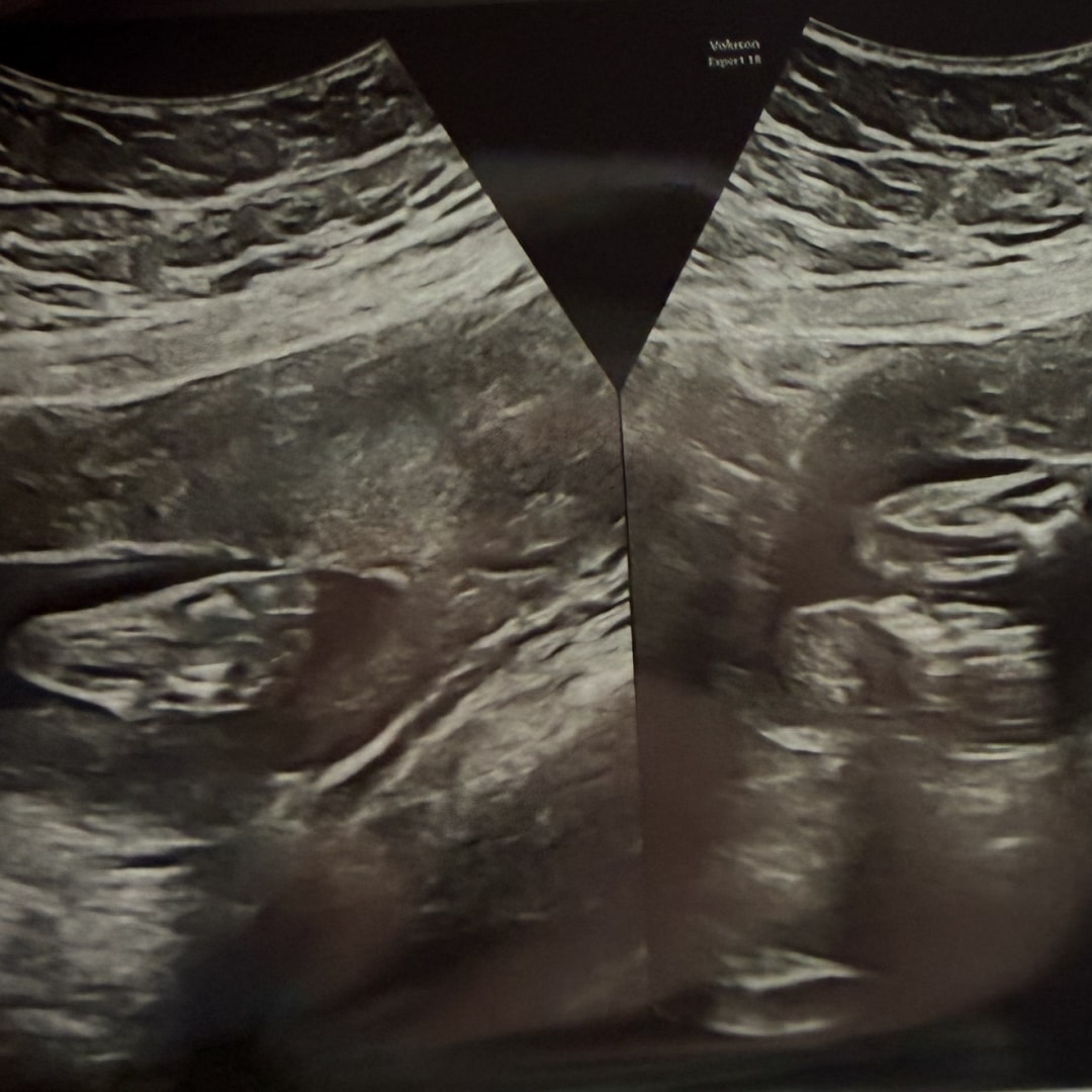 Photo shared by Ashley for their Babylist baby registry.