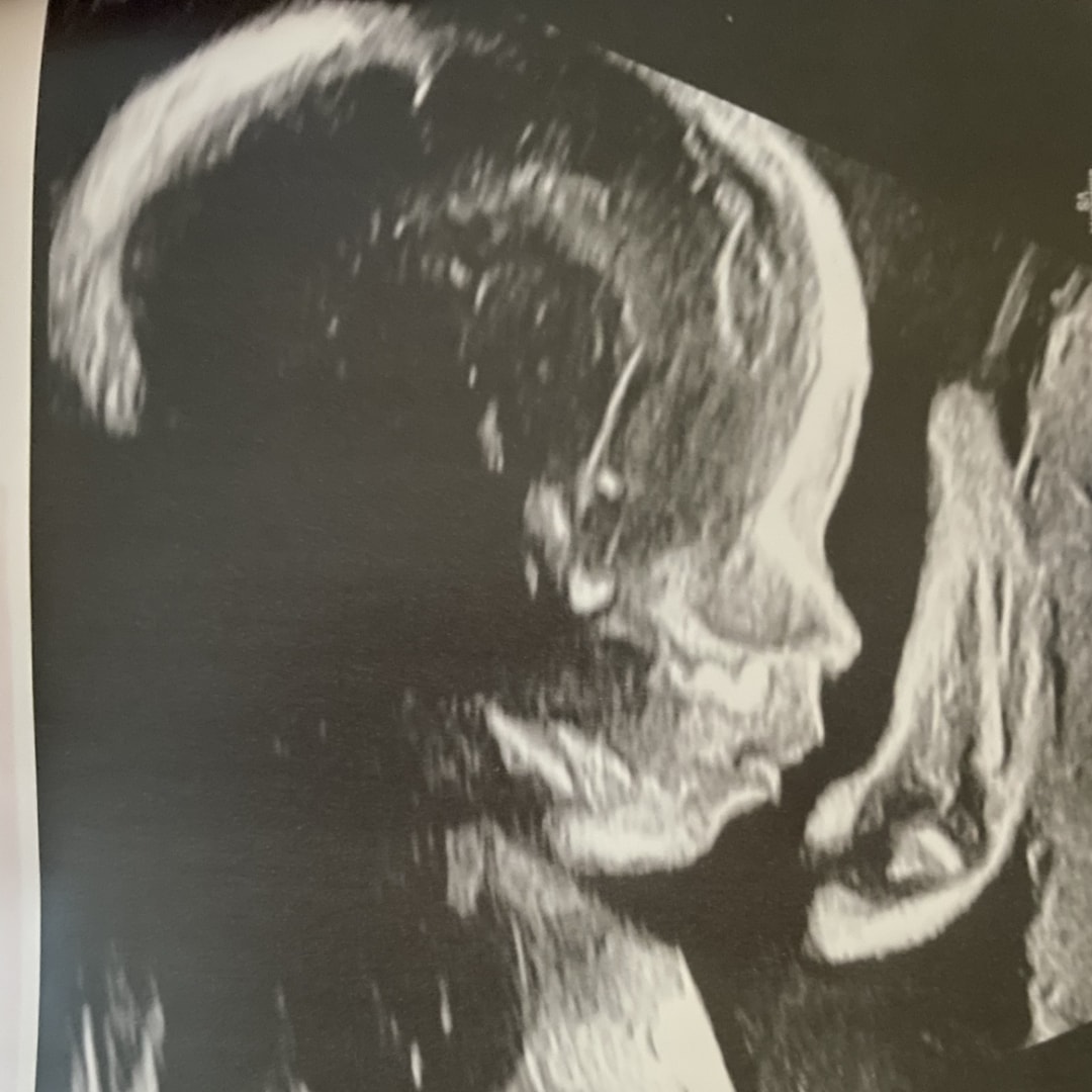 Photo shared by Leslie for their Babylist baby registry.