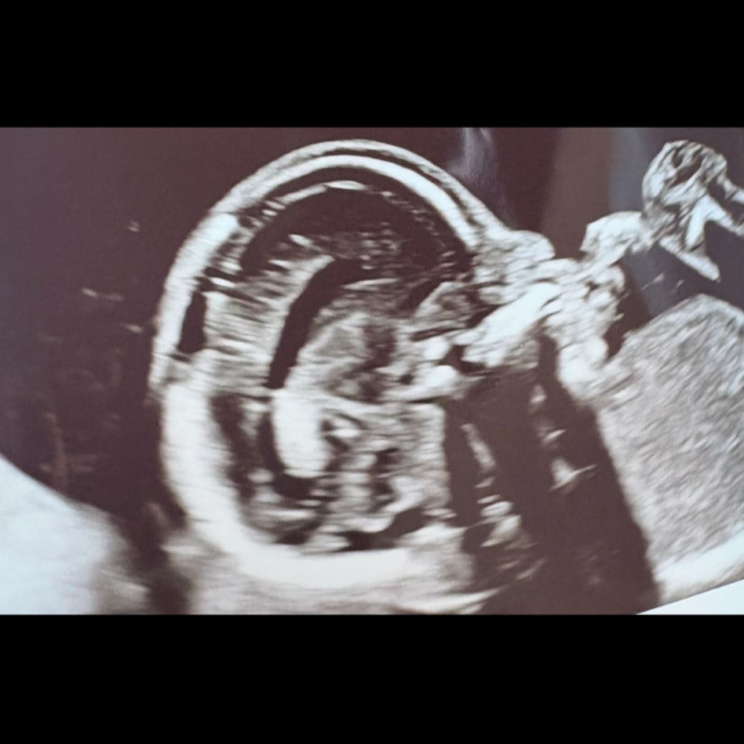 Photo shared by Emily for their Babylist baby registry.