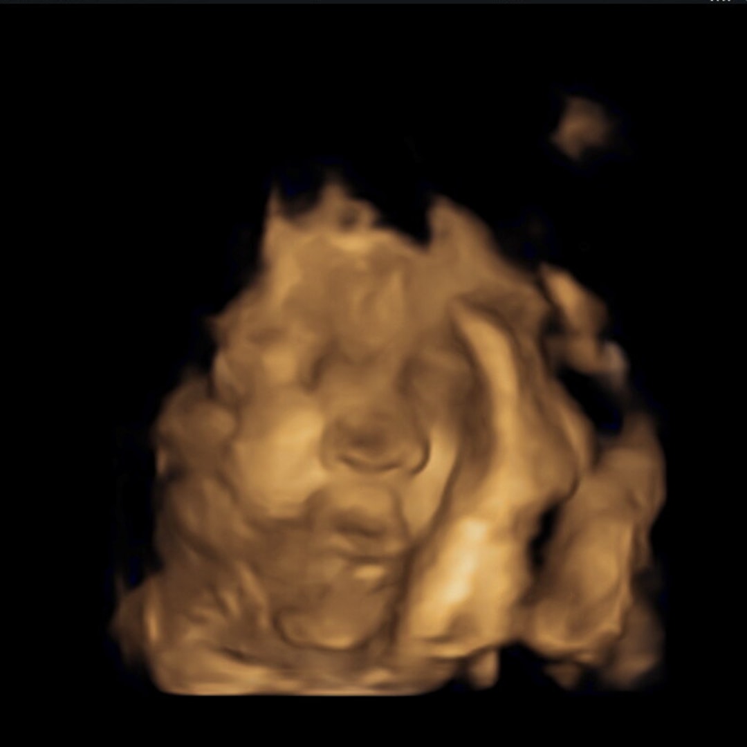 Photo shared by Ashleigh for their Babylist baby registry.