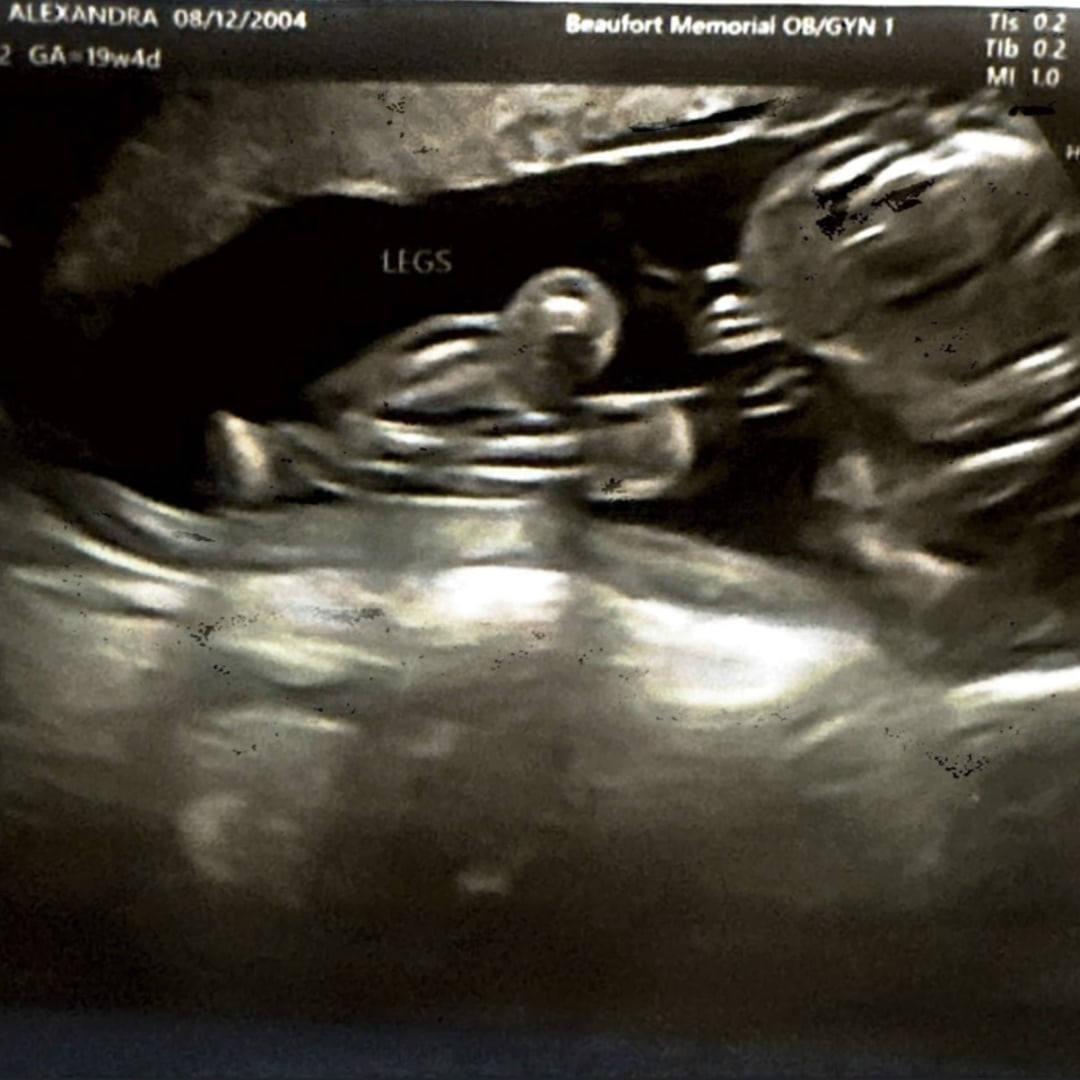 Photo shared by Alexandra for their Babylist baby registry.