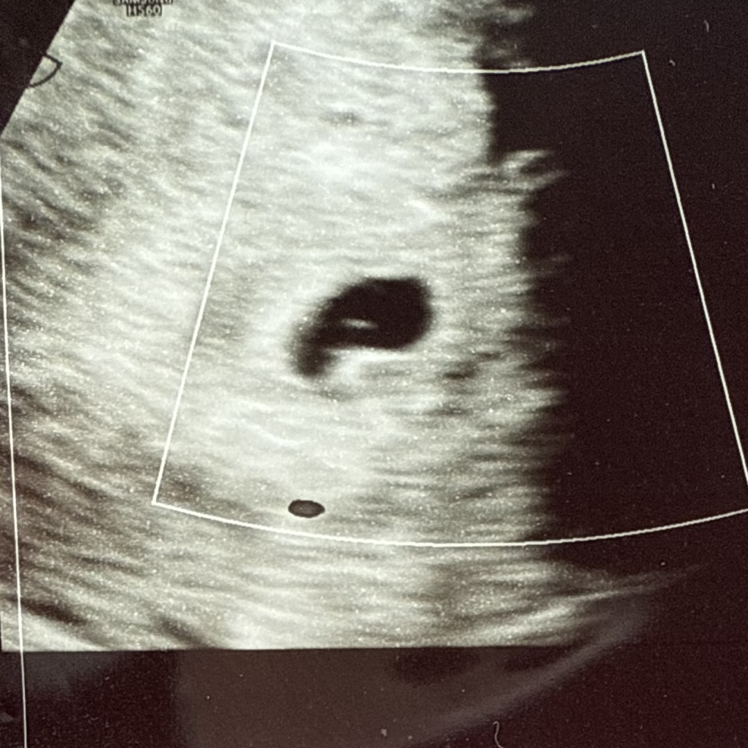 Photo shared by Sofia for their Babylist baby registry.