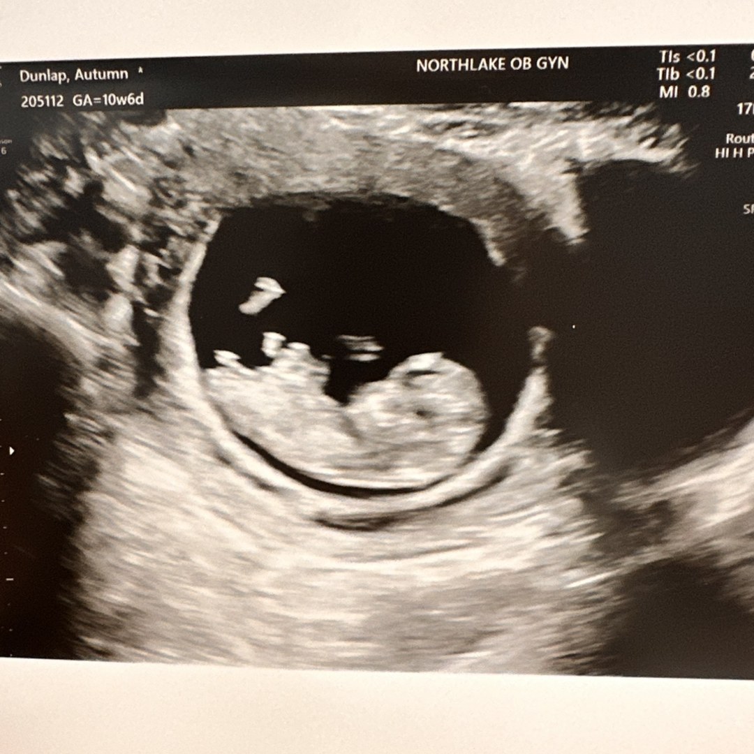 Photo shared by Autumn for their Babylist baby registry.