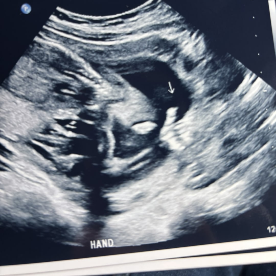 Photo shared by Ashanti for their Babylist baby registry.