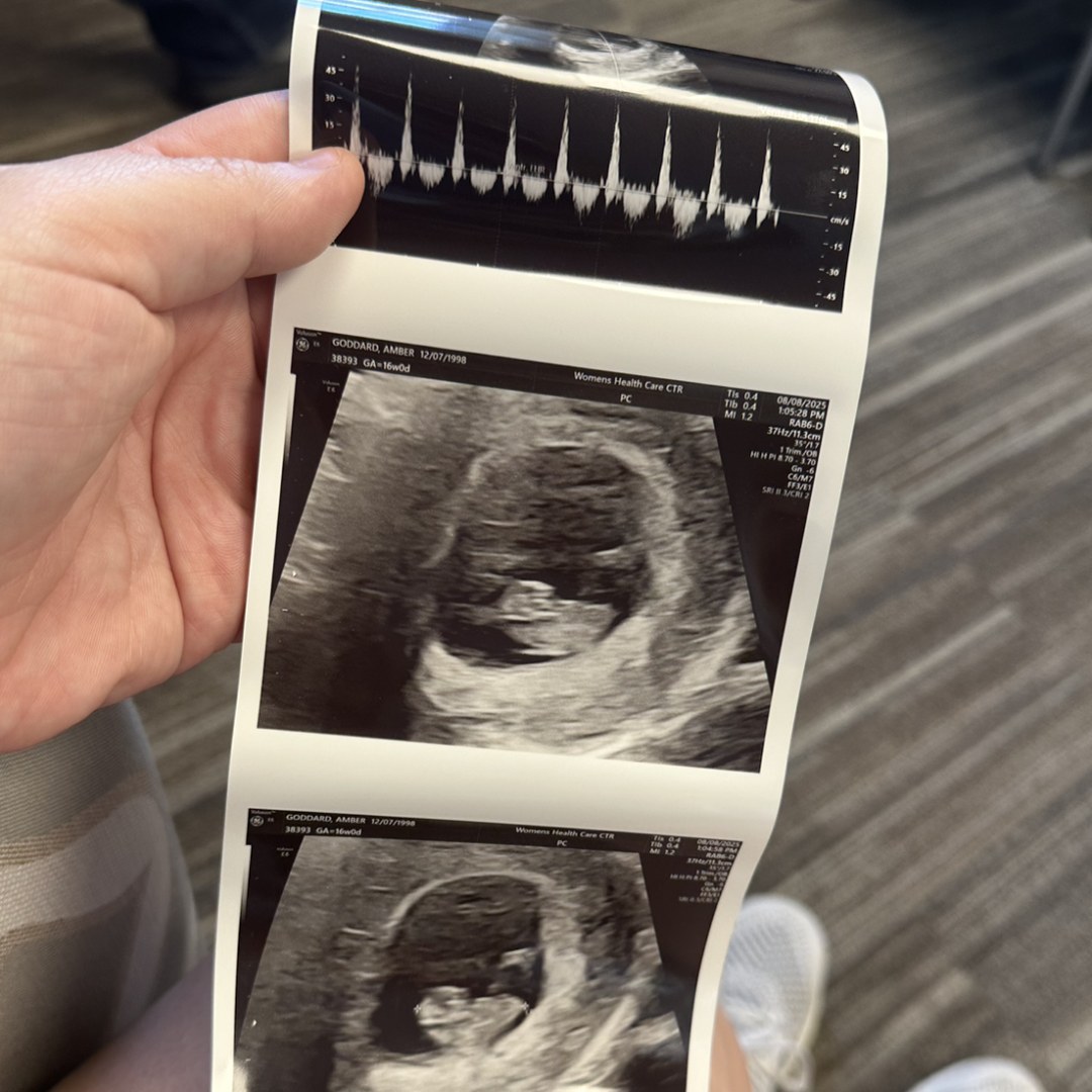 Photo shared by Amber for their Babylist baby registry.