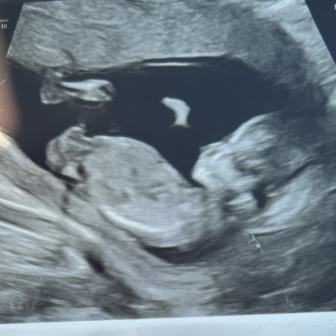 Photo shared by Marcela for their Babylist baby registry.