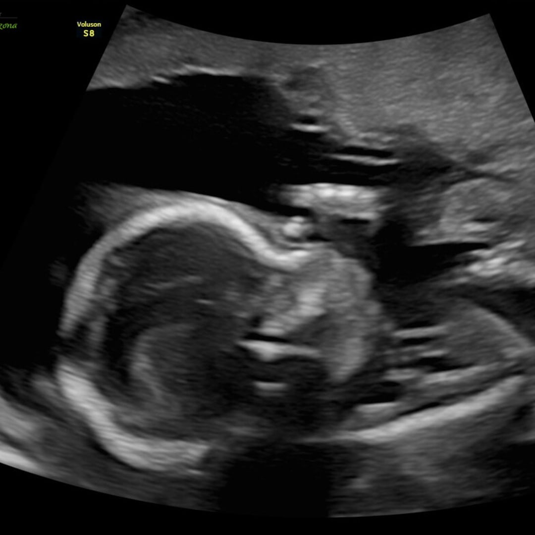 Photo shared by Kirsti for their Babylist baby registry.