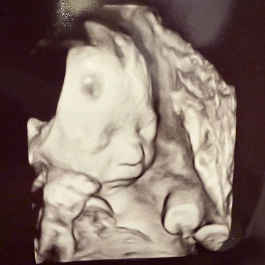 Photo shared by Sarah for their Babylist baby registry.