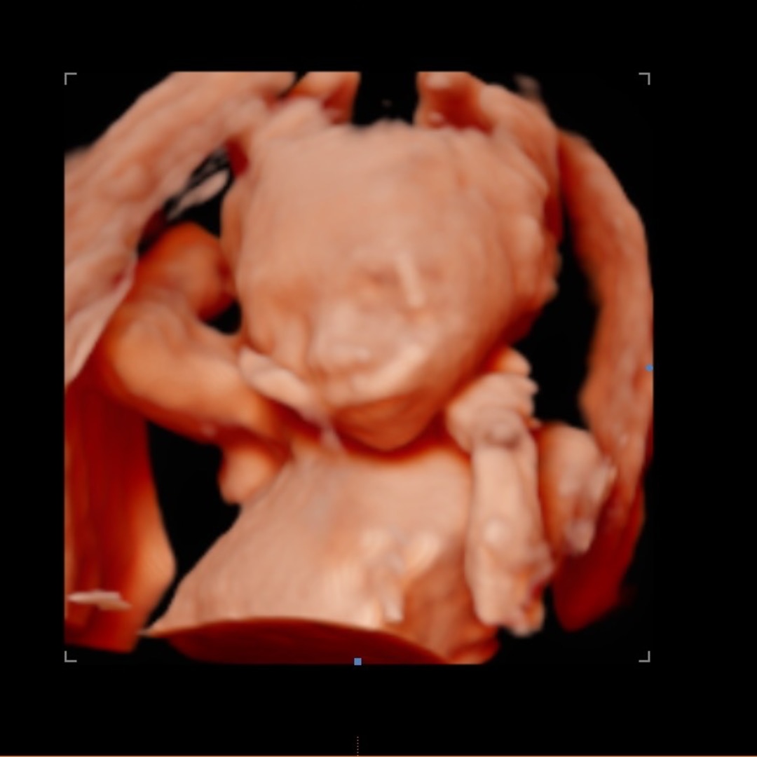 Photo shared by Krystal for their Babylist baby registry.