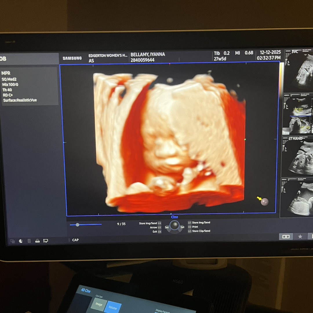 Photo shared by Iyanna for their Babylist baby registry.