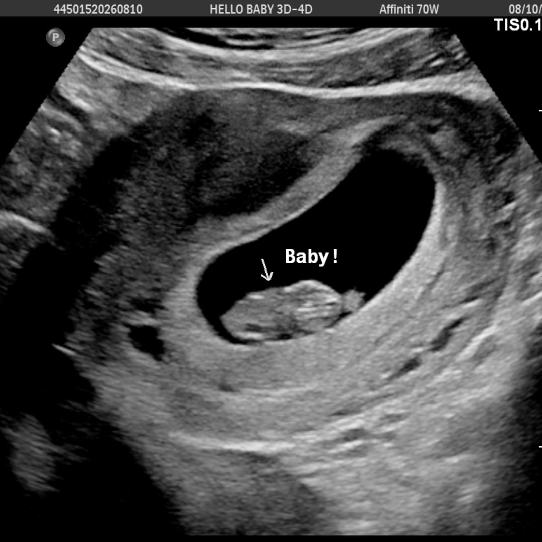 Photo shared by Abigail for their Babylist baby registry.