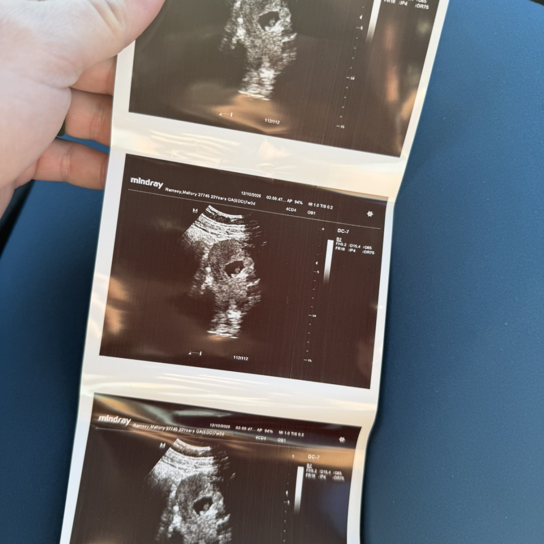Photo shared by Mallory for their Babylist baby registry.