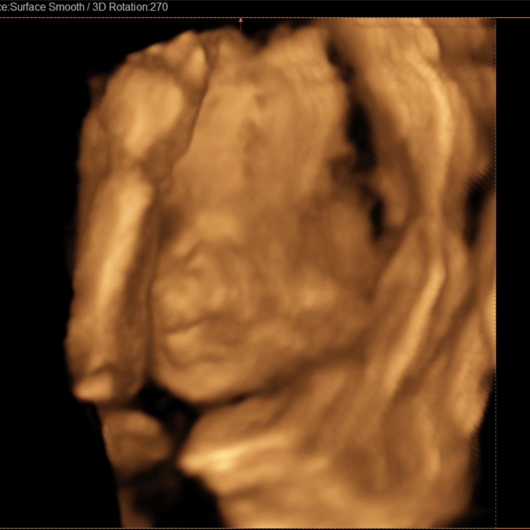 Photo shared by Alyissa for their Babylist baby registry.