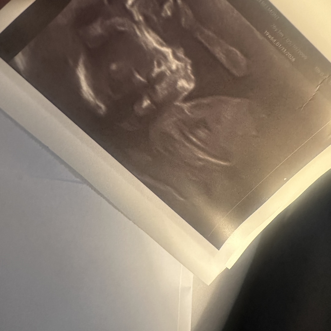 Photo shared by Taylor for their Babylist baby registry.