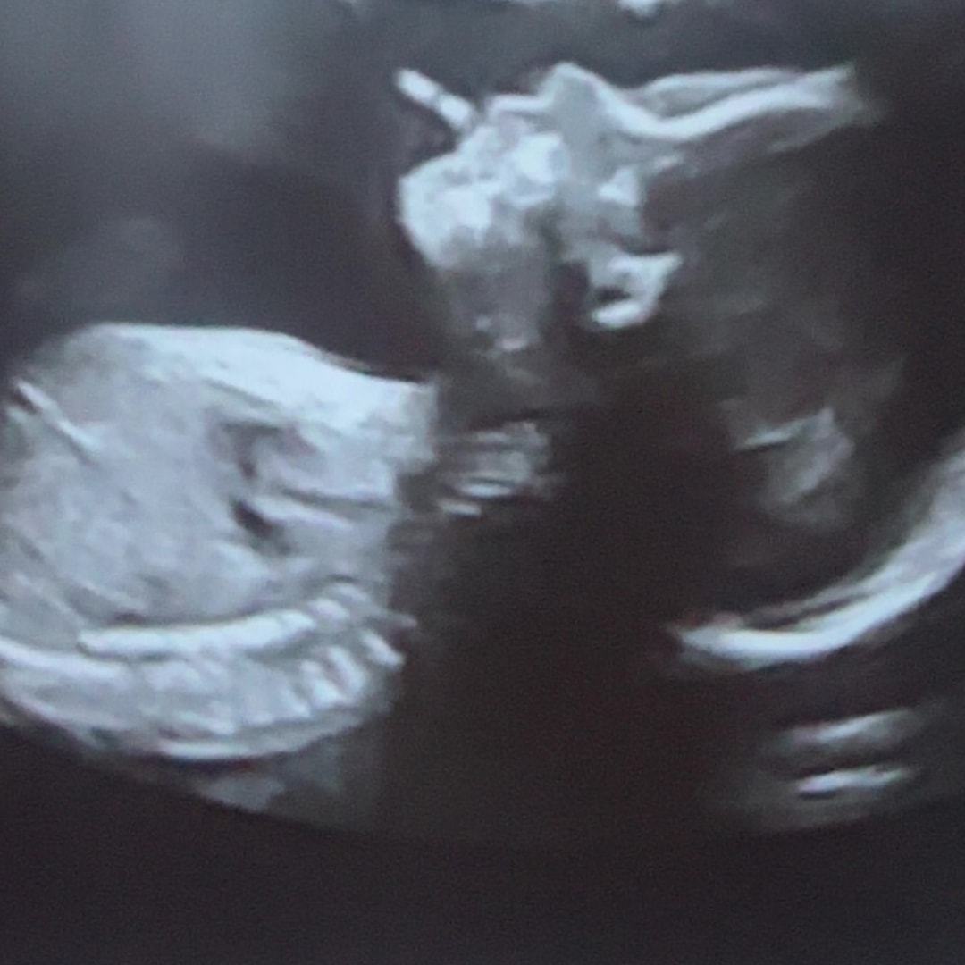 Photo shared by Georgia for their Babylist baby registry.